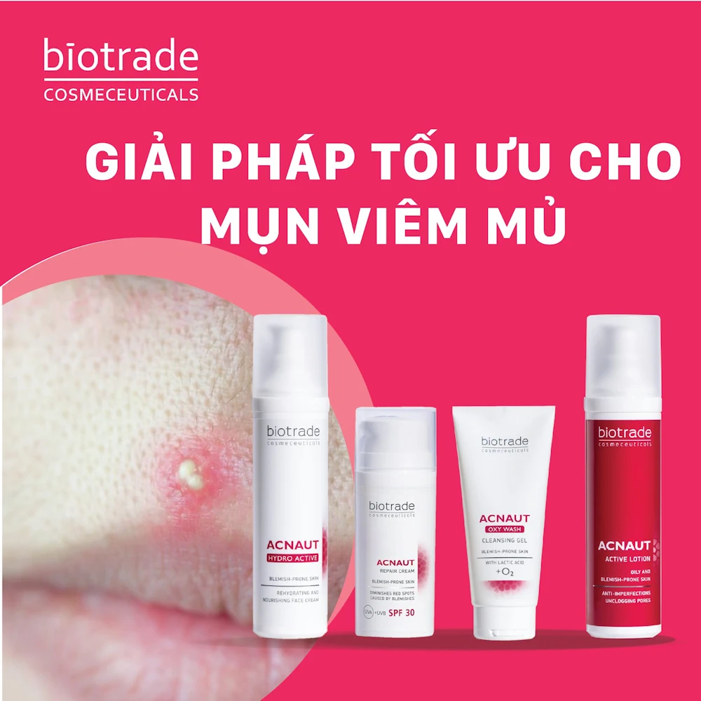 Combo Giảm Mụn Viêm Mủ Biotrade Acnaut - Giải Pháp Tối ưu Cho Mụn Viêm Mủ - 7mart.vn Combo Giảm Mụn Viêm Mủ Biotrade Acnaut - Giải Pháp Tối ưu Cho Mụn Viêm Mủ - 7Mart.vn