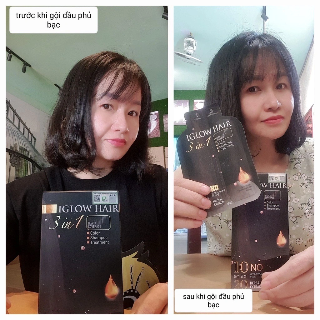 feedback iglow hair - review iglow hair - iglow hair có tốt không - iglow hair có hiệu quả không - 7mart.vn - 1