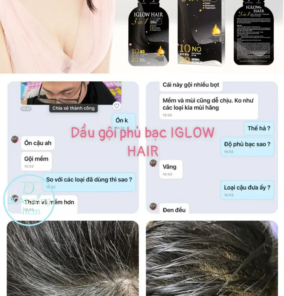 feedback iglow hair - review iglow hair - iglow hair có tốt không - iglow hair có hiệu quả không - 7mart.vn - 10