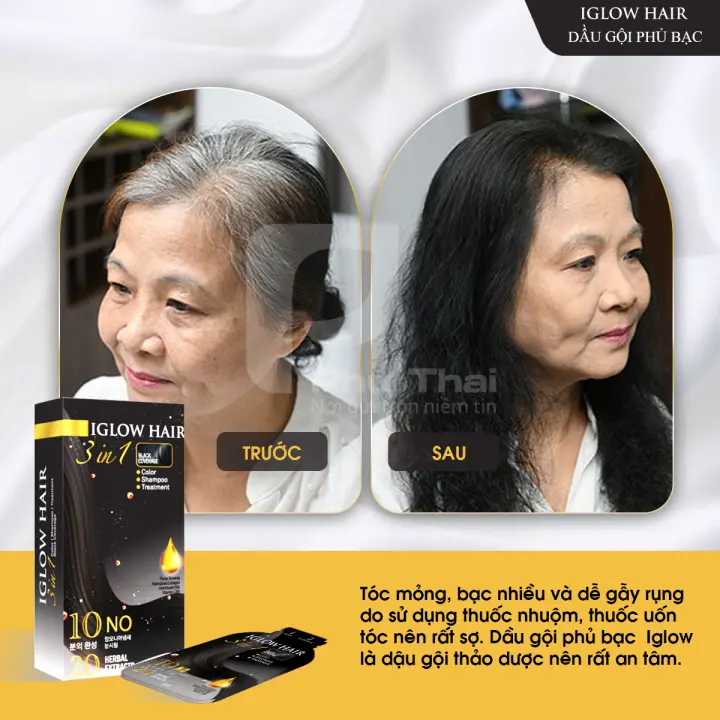 feedback iglow hair - review iglow hair - iglow hair có tốt không - iglow hair có hiệu quả không - 7mart.vn - 11