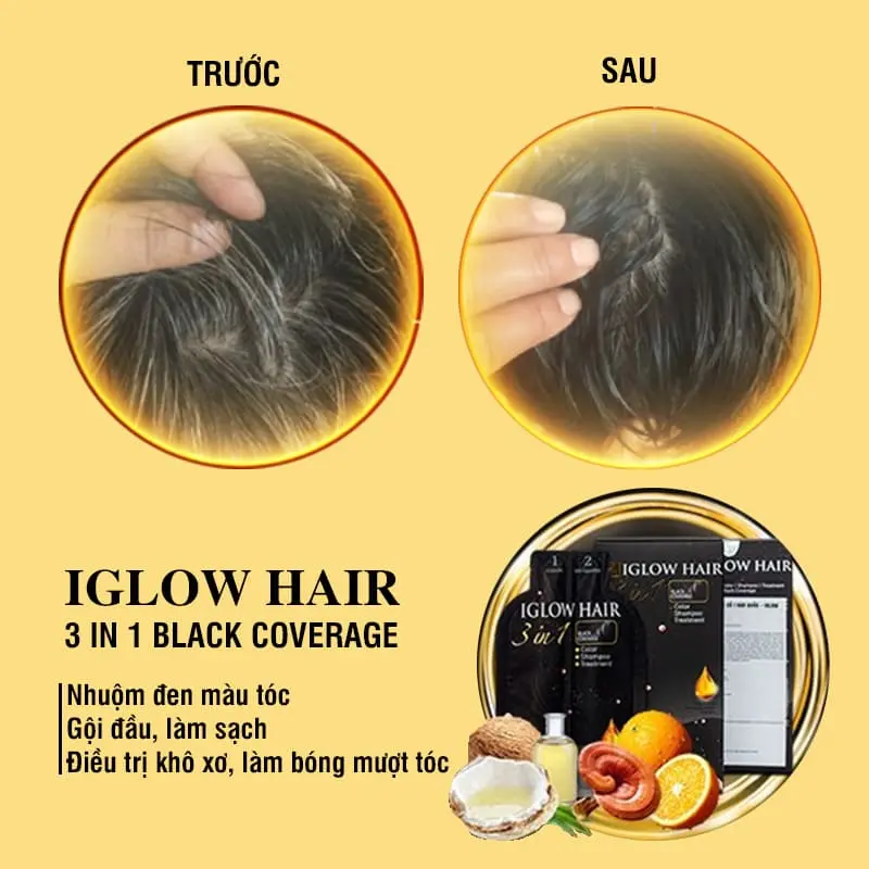 feedback iglow hair - review iglow hair - iglow hair có tốt không - iglow hair có hiệu quả không - 7mart.vn - 2