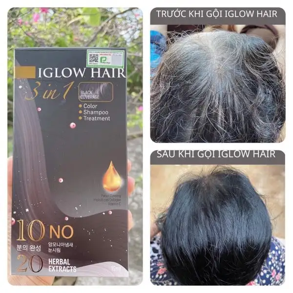 feedback iglow hair - review iglow hair - iglow hair có tốt không - iglow hair có hiệu quả không - 7mart.vn - 3