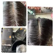 feedback iglow hair - review iglow hair - iglow hair có tốt không - iglow hair có hiệu quả không - 7mart.vn - 4