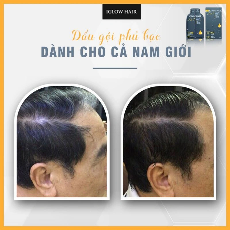 feedback iglow hair - review iglow hair - iglow hair có tốt không - iglow hair có hiệu quả không - 7mart.vn - 8