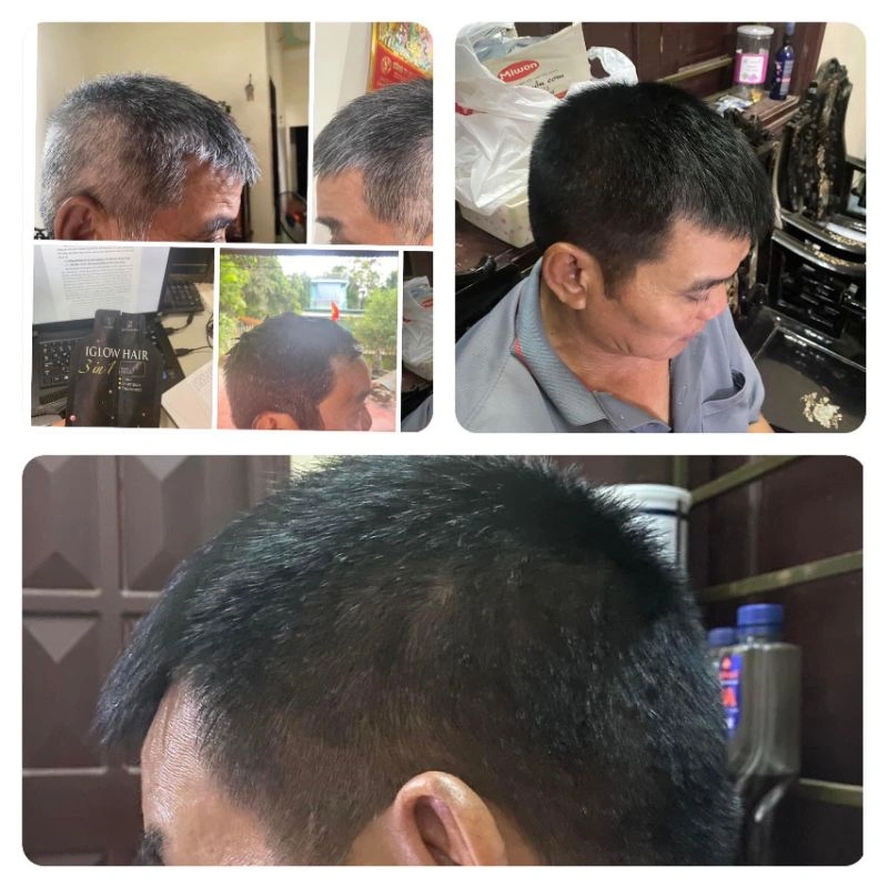 feedback iglow hair - review iglow hair - iglow hair có tốt không - iglow hair có hiệu quả không - 7mart.vn - 9