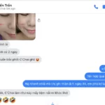 Review Dưỡng Mi Tế Bào Gốc C'choi - Bio-placenta Lash Serum - Punar - 7Mart.vn - Hình 10